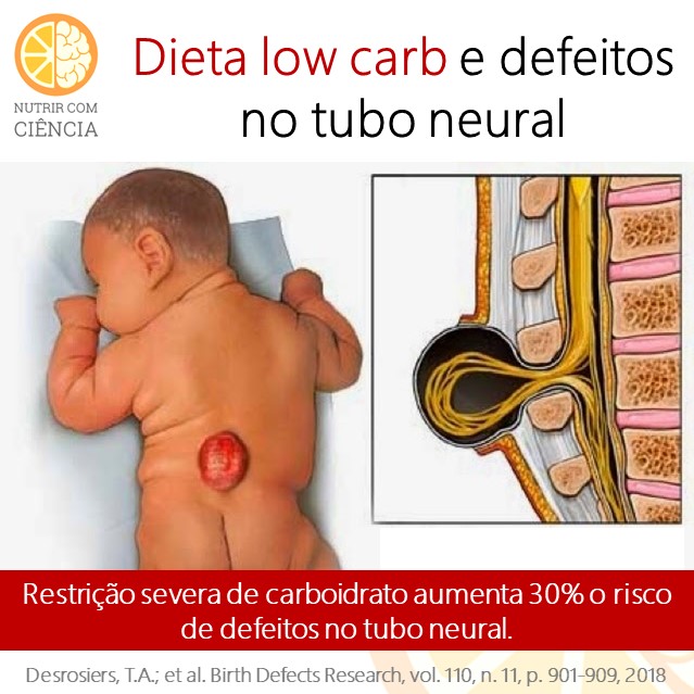 Low carb e tubo neural